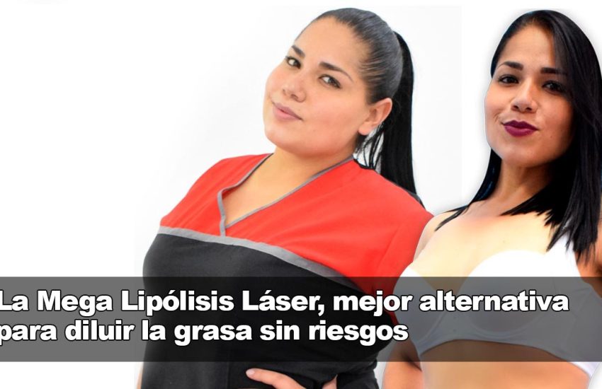 Puedes rebajar el sobrepeso con todos los beneficios de la Mega Lipólisis Láser